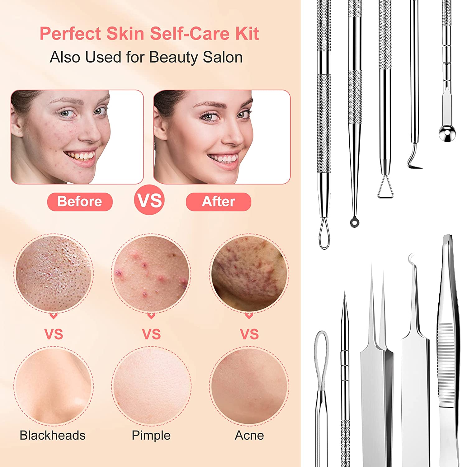 Kit De 10 Herramientas para Acné Y Puntos Negros.