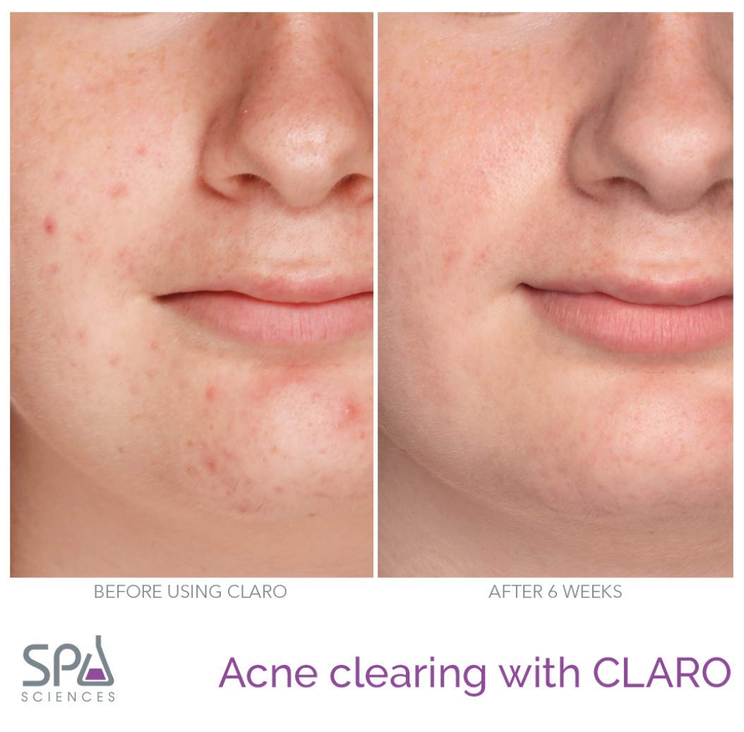 Terapia De Luz Facial Aprobado FDA, Recargable.