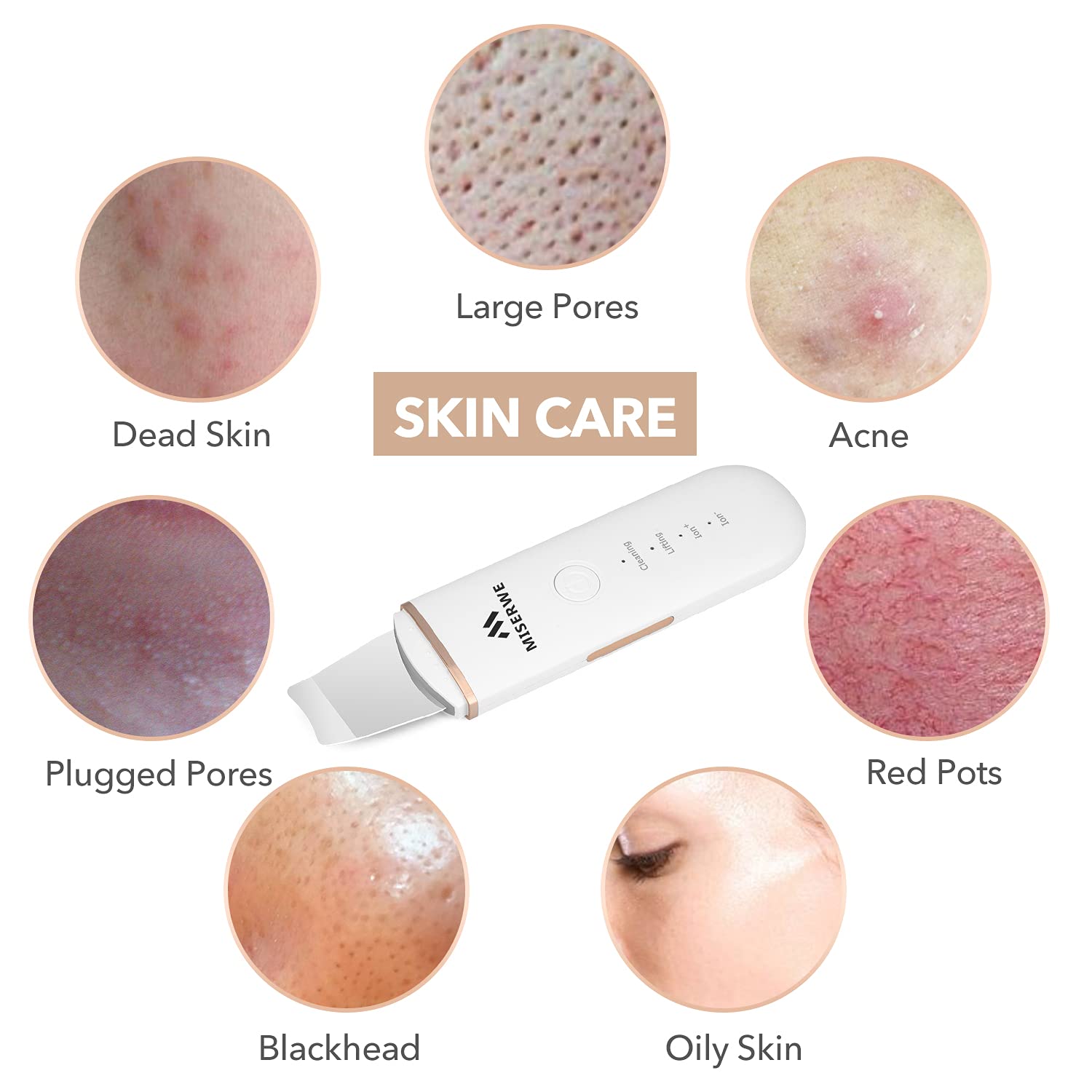 Limpiador De Poros Espátula Exfoliante Facial Teletiendauy