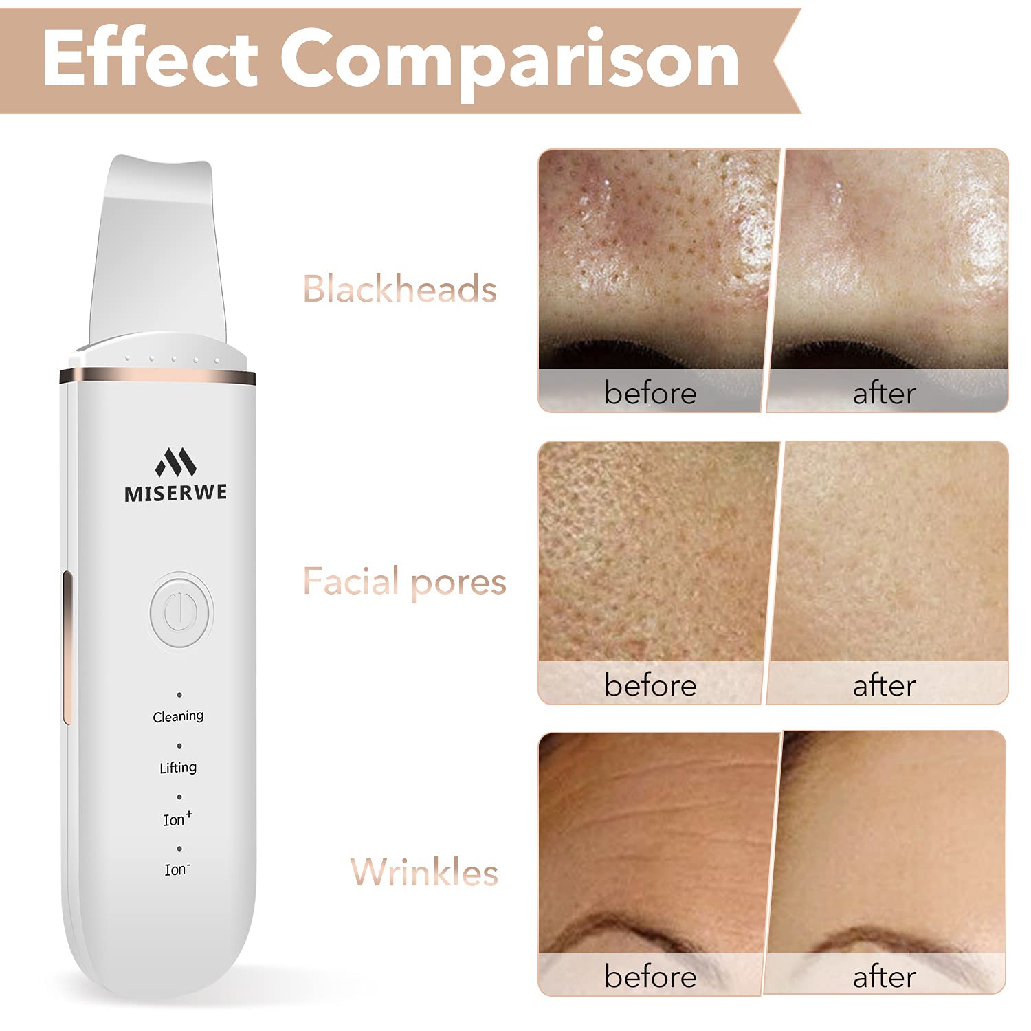 Limpiador De Poros Espátula Exfoliante Facial Teletiendauy